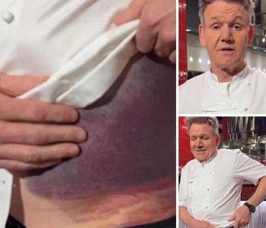 Gordon Ramsay Shares Important Message After Potentially Fatal Accident