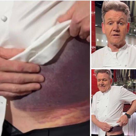 Gordon Ramsay Shares Important Message After Potentially Fatal Accident