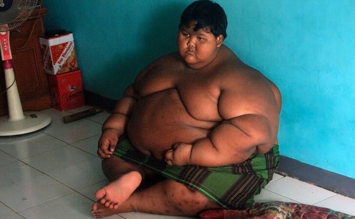 Arya, The Former “World’s Fattest Kid” Lost Weight