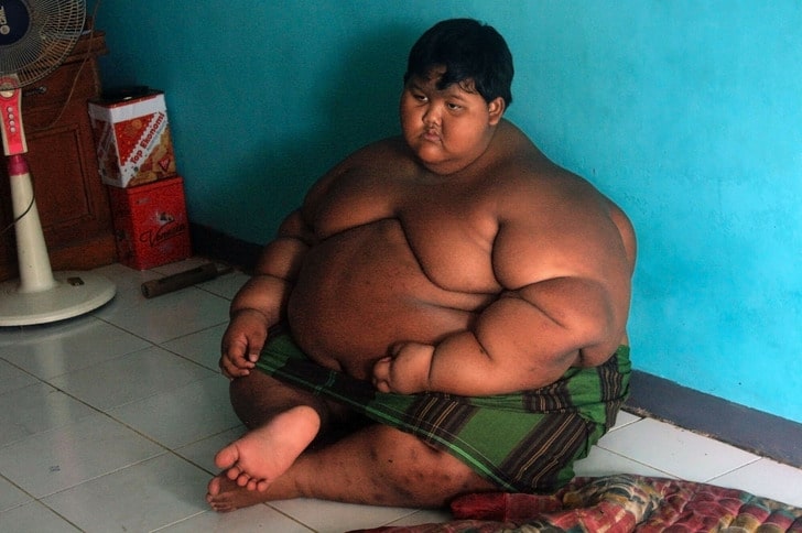 Arya, The Former “World’s Fattest Kid” Lost Weight