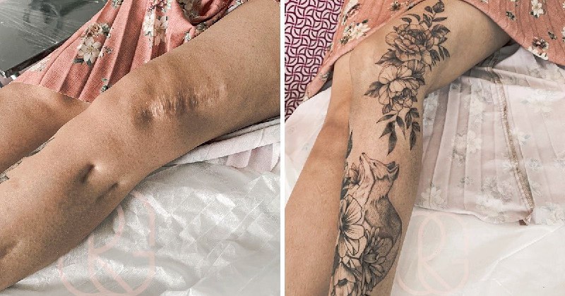 16 Iconic Transformations Of Scars Into Beautiful Tattoos