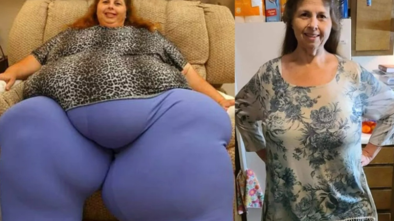 This woman lost 518 pounds at 57 and here is what she looks like after…