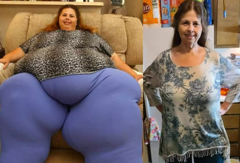 This woman lost 518 pounds at 57 and here is what she looks like after…