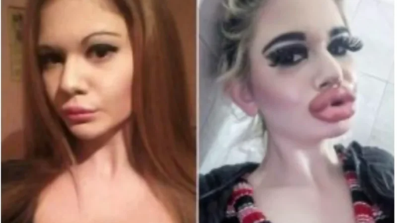 She lost all her beauty because of surgeons and here is what she used to look like before…