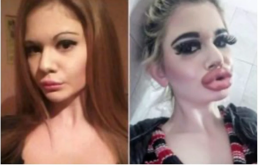 She lost all her beauty because of surgeons and here is what she used to look like before…