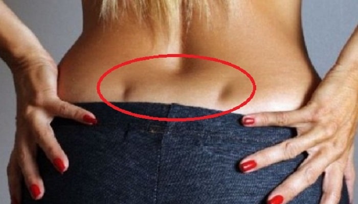 Venus Holes On Your Back: What They Reveal About You