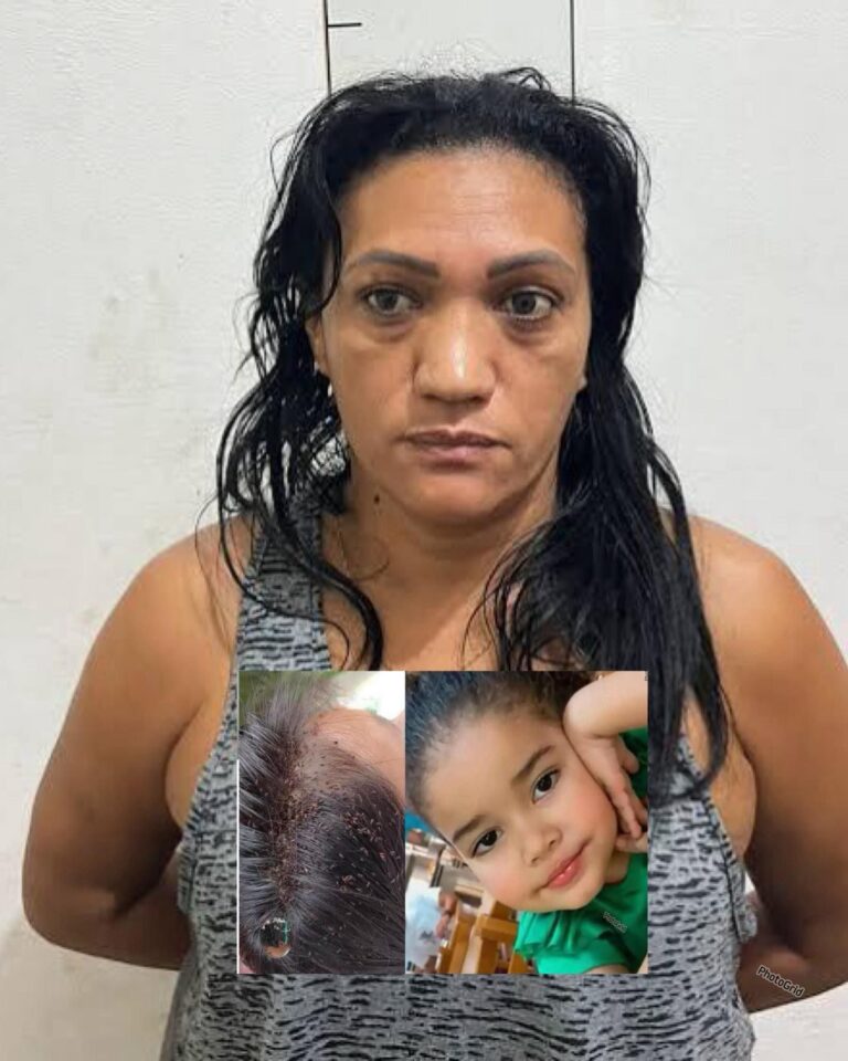 3-year-old girl passed away after lice and mother warns… See More