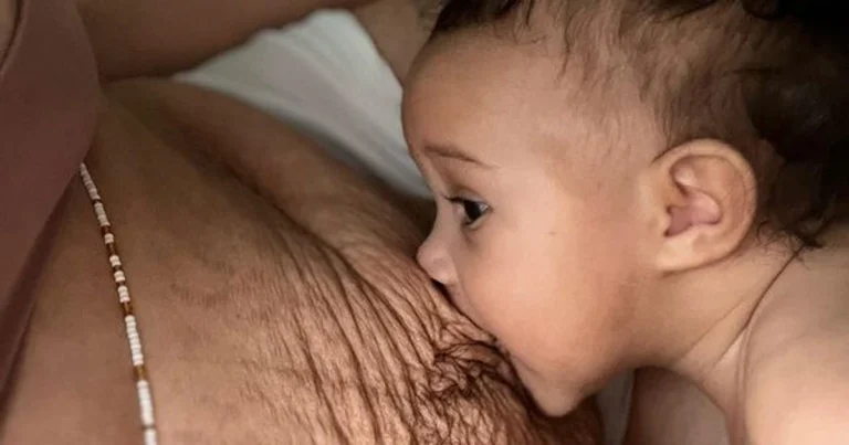 A Woman Shows What a Real Postpartum Body Actually Looks Like