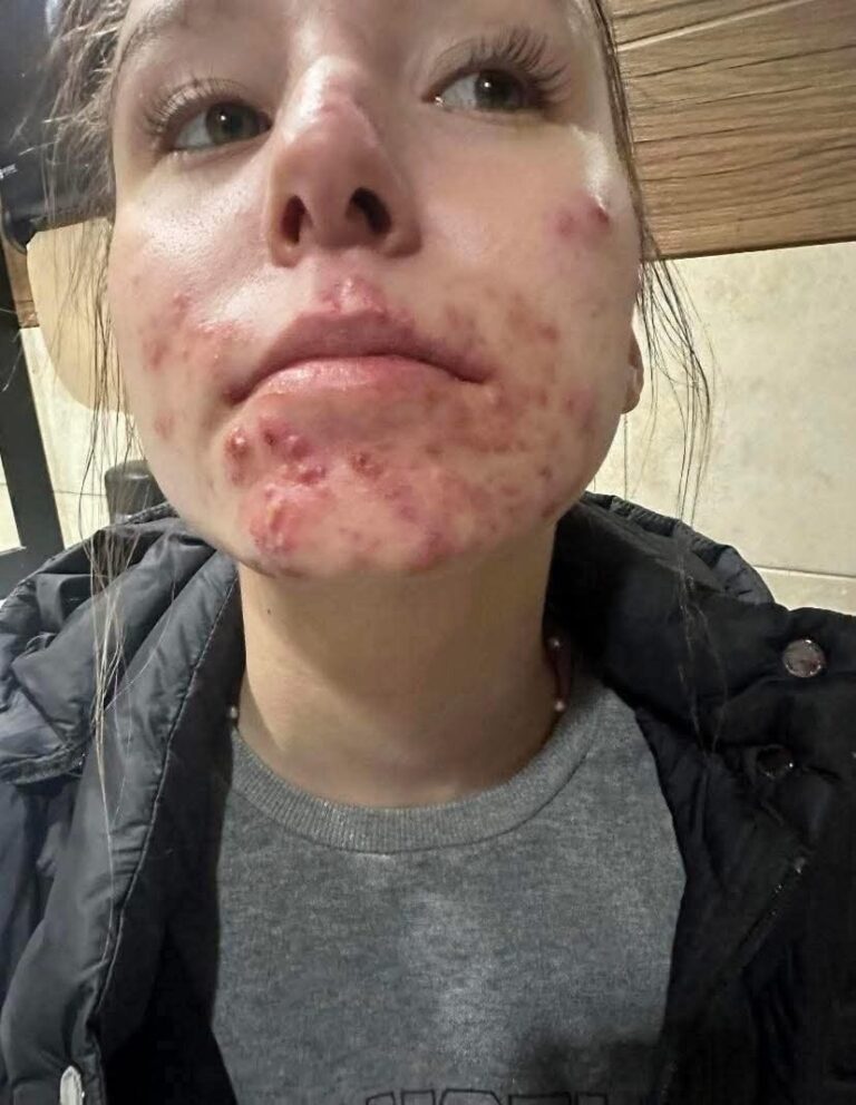 These are the consequences of sleeping with…