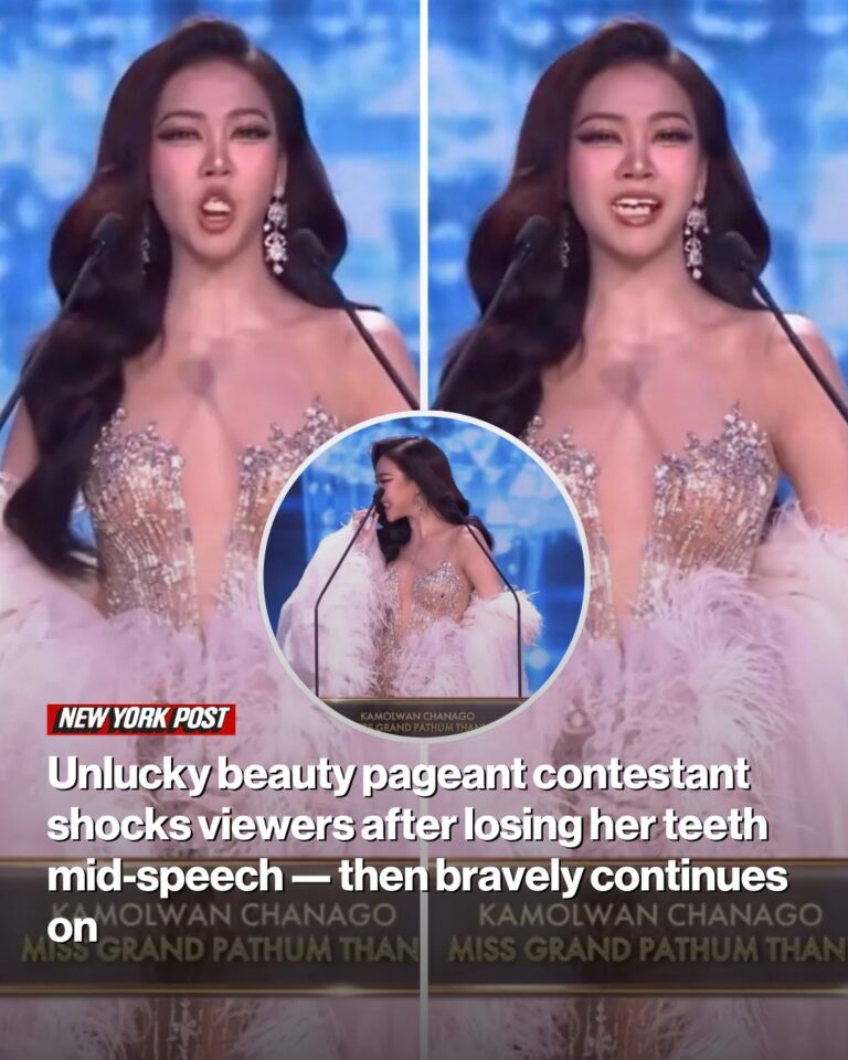 Unlucky beauty pageant contestant shocks viewers after losing her teeth mid-speech — then bravely continues on