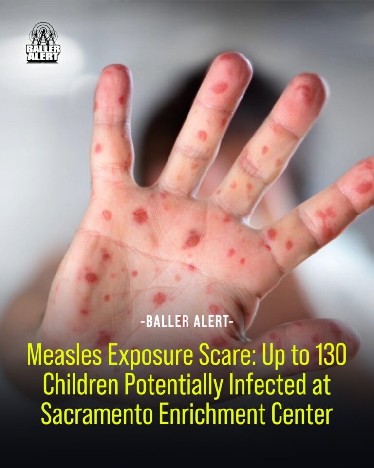 Measles Exposure Scare: Up to 130 Children Potentially Infected at Sacramento Enrichment Center