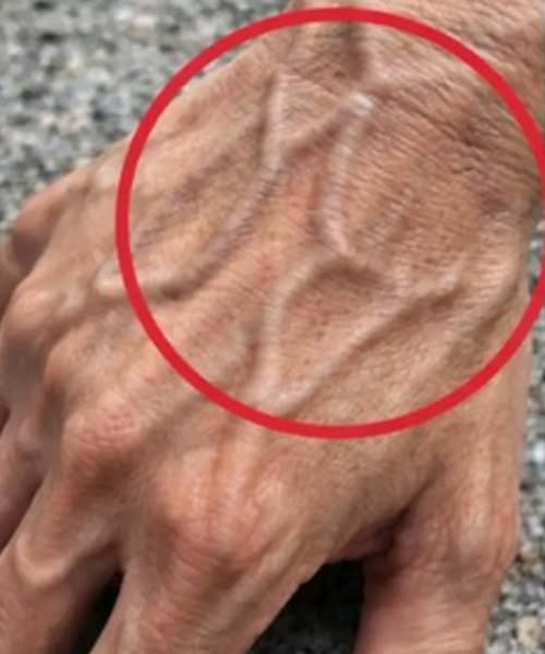 What Visible Veins Might Say About Your Body