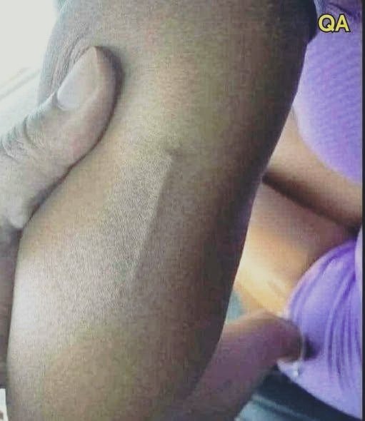 Something Appeared on My Daughter’s Arm and I Had No Idea What It Was