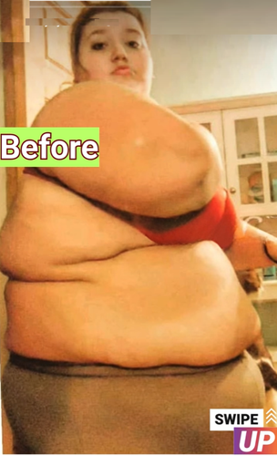 Lexi Reed’s Inspiring Transformation: From Battling a Rare Disease at 485 Pounds to Rocking a Swimsuit with Confidence