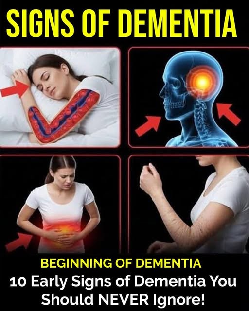 10 Early Signs of Dementia You Should NEVER Ignore…
