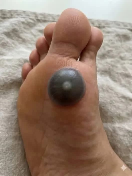 My daughter woke up with this huge