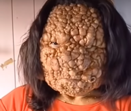IS YOUR CHIN DESTROYING YOUR LOVE LIFE AND CONFIDENCE!