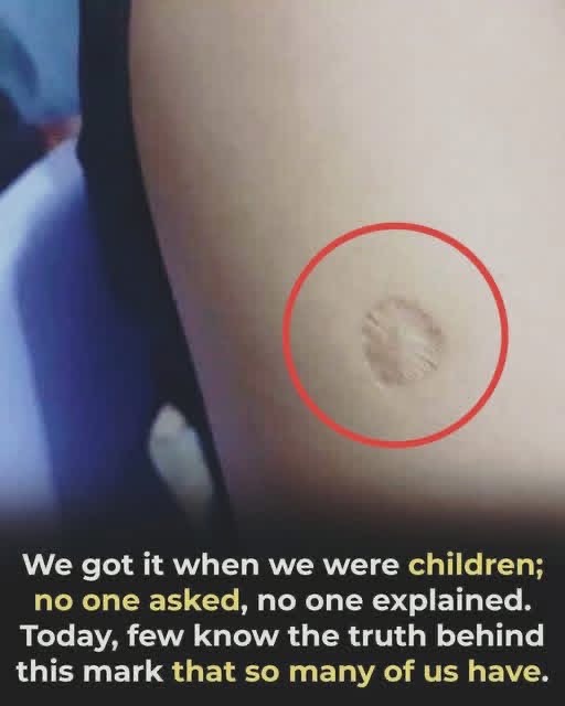What the small round scar on your arm might indicate