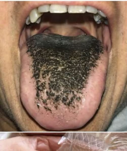 These are the consequences of sleeping with the