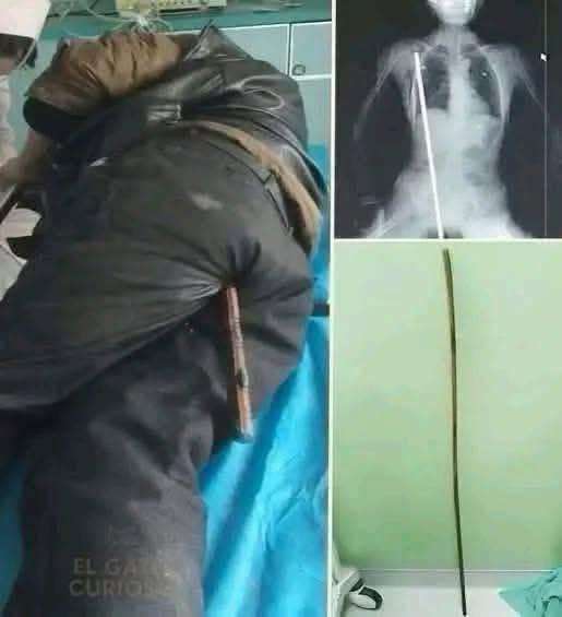 SHOCKING POLICE CUSTODY CRISIS: Young Man Left Fighting for His Life After Routine Arrest Gone Wrong!