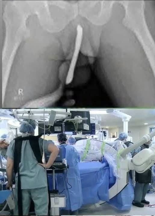 News Hospitalized After Risky Experiment