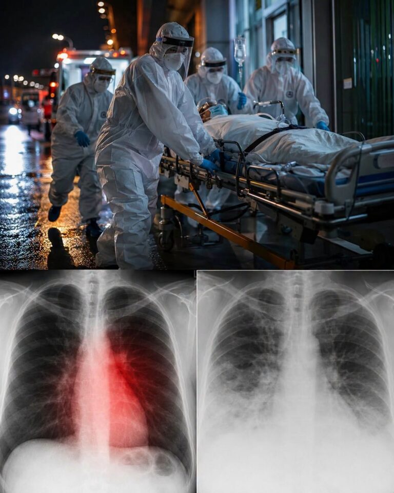 Scientists Discover What May Be Causing Certain Cases of Heart Inflammation