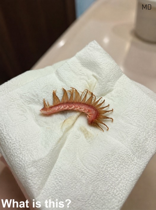 What My Girlfriend Found After Walking the Dog Left Us Completely Confused