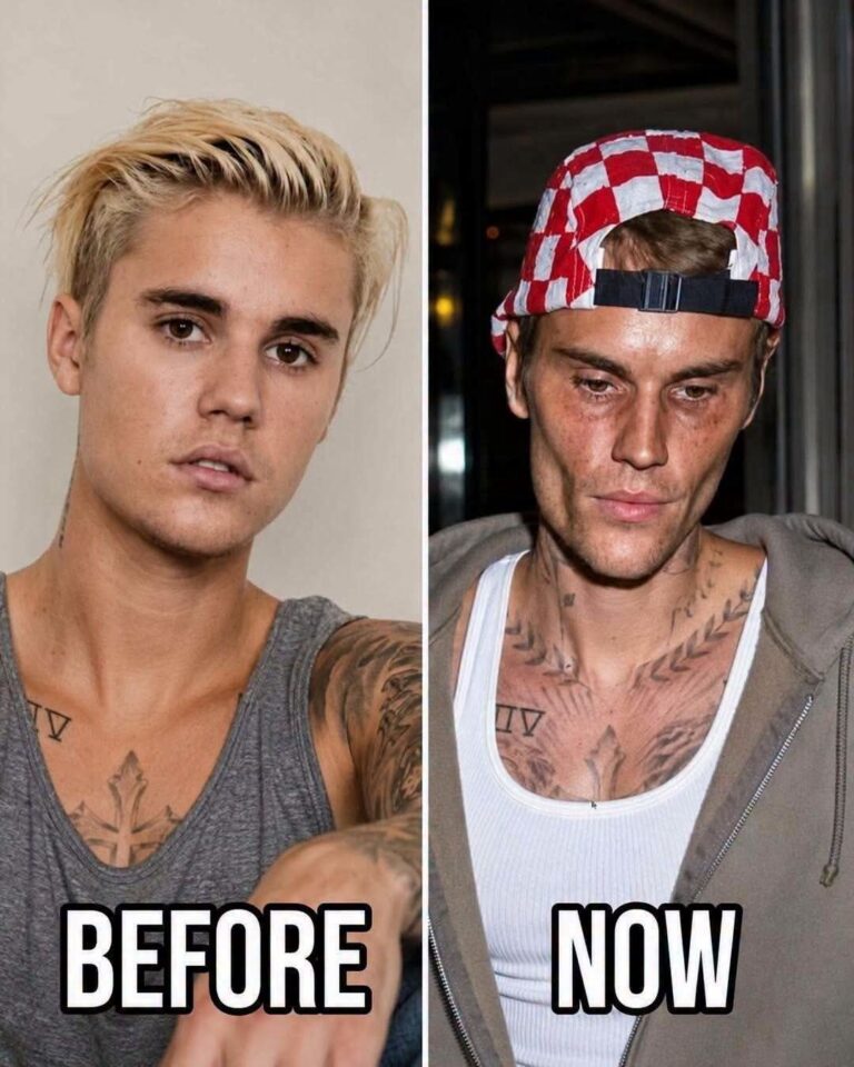 🥺Justin Bieber admits that he tested positive for…See more