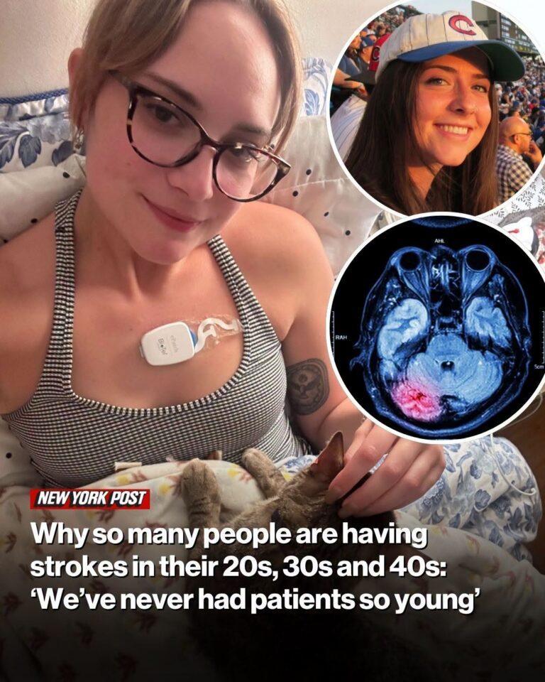 Why so many people are having strokes in their 20s, 30s and 40s: ‘We’ve never had patients so young’