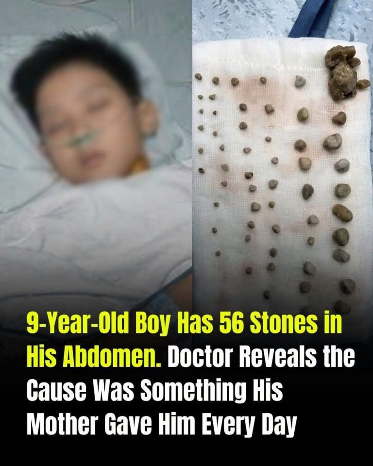Childhood Kidney Stones: What Every Parent Should Know About Prevention