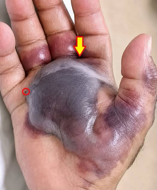 You Might Be Ignoring a Deadly Ticking Time Bomb on Your Own Skin