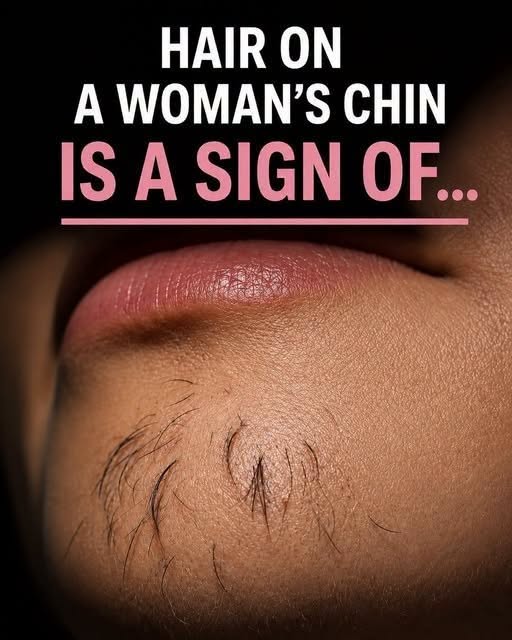 Hair on a woman’s chin is a sign of…👇👇