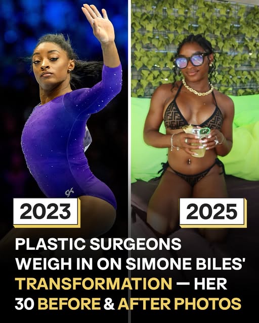 ‘God Made Me This Way’: Simone Biles’ Transformation After Years of Body Shaming, in 30 Photos
