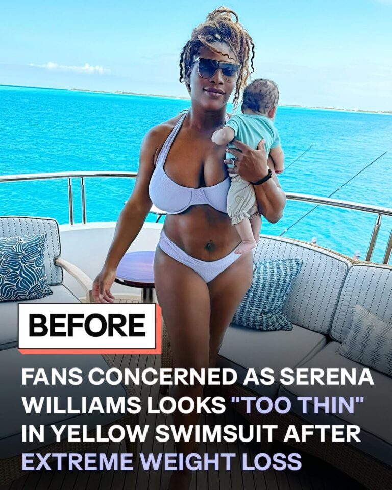 Serena Williams Stuns in Bold Yellow Swimsuit After Dramatic Weight Loss Reveal