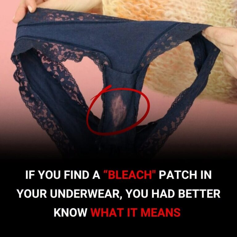 Why Light Spots Can Appear on Underwear: The Natural Science Behind a Common Occurrence